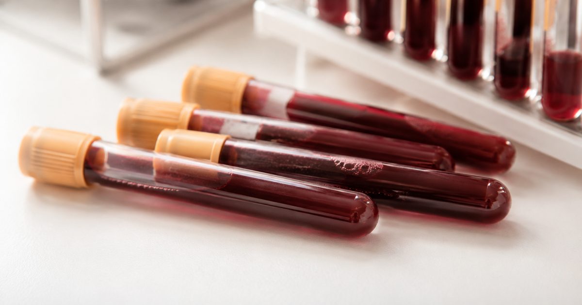 Bilan biologique complet dans le Covid long