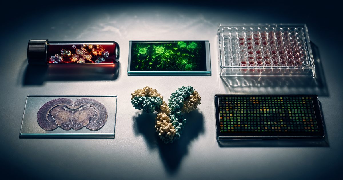 Illustration des six mécanismes biologiques du Covid long