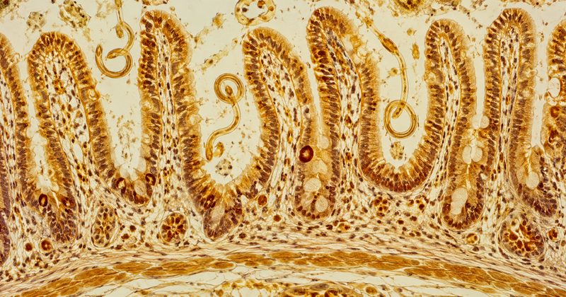 Helminthes thérapeutiques et immunité — illustration de la relation hôte-parasite dans le contexte du Covid long