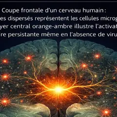 Microglie primée : Covid long et EM/SFC