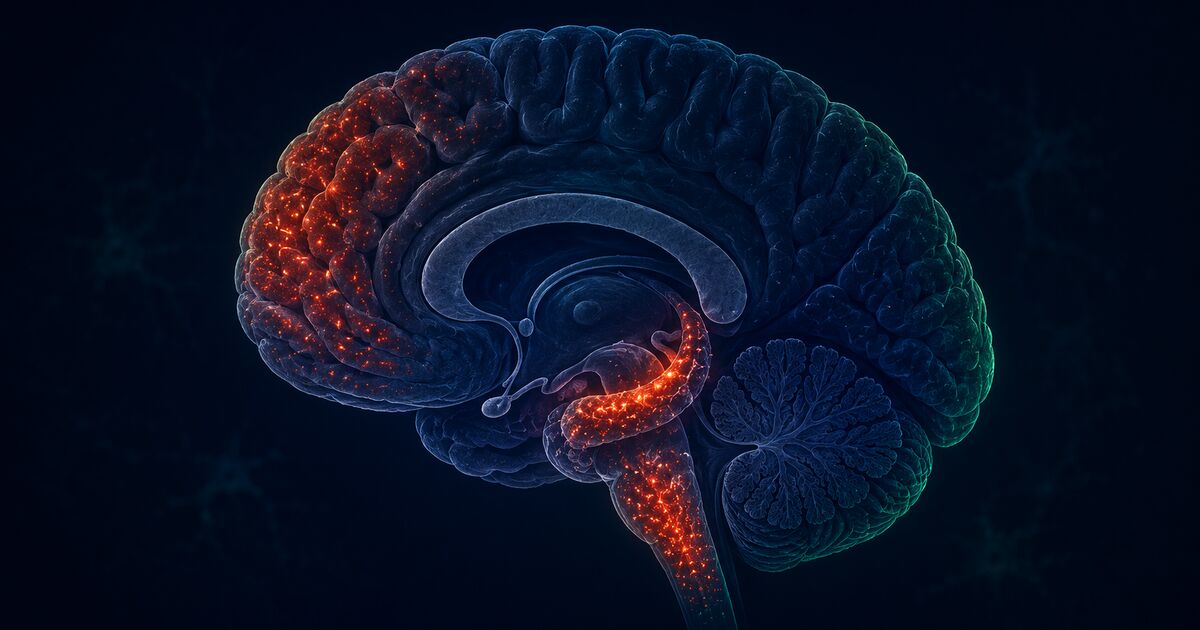 Microglie primée — neuroinflammation et Covid long