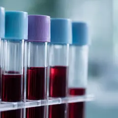 Covid long : un profil vasculaire au VEGF-A